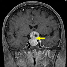 写真：MRI3