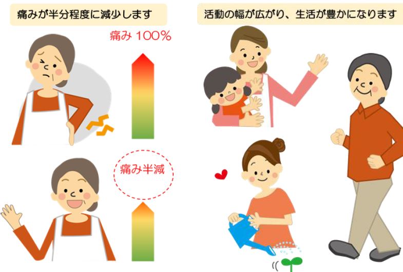 イラスト：脊髄刺激療法の効果を表すイメージ